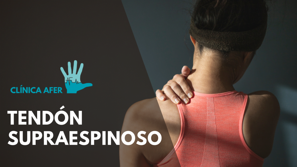 Imagen del artículo sobre el tendón supraespinoso