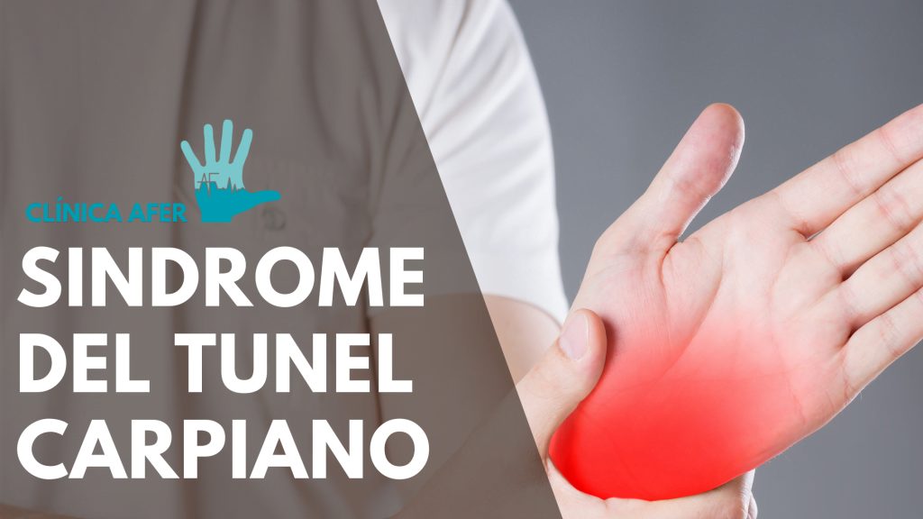Imagen del artículo sobre el sindrome del tunel carpiano