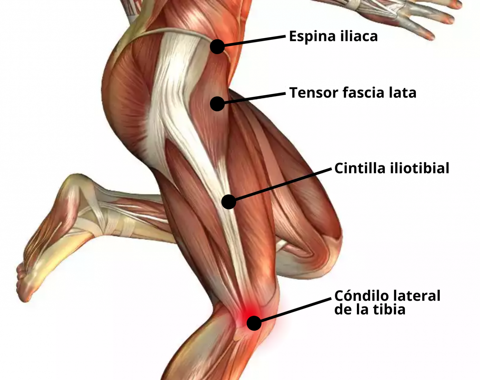 imagen del articulo sindrome del corredor