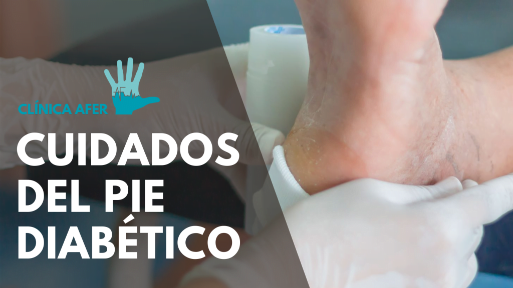 Imagen del artículo sobre cuidados del pie diabético