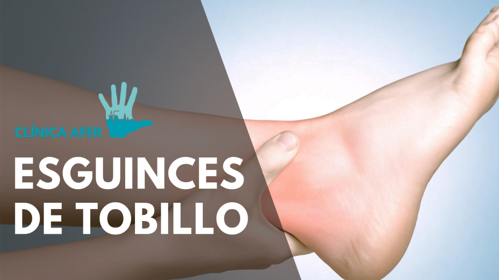Imagen del artículo sobre esguinces de tobillo
