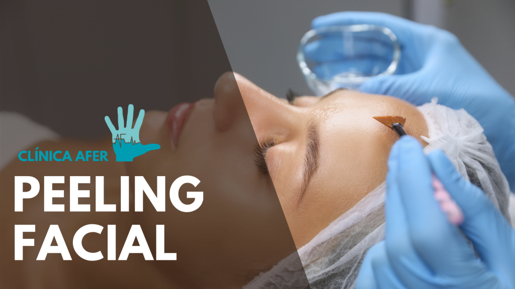 Imagen del artículo sobre el peeling facial