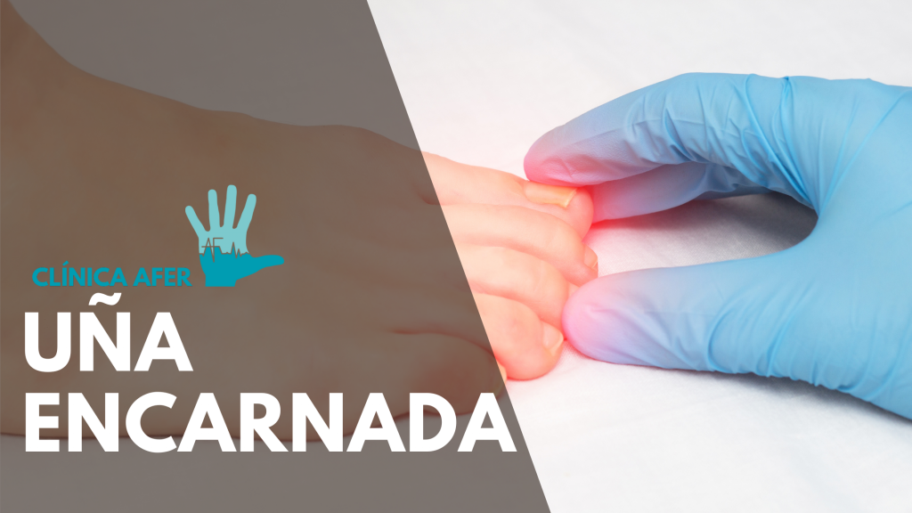 Imagen del artículo sobre los tratamientos para las uñas encarnadas