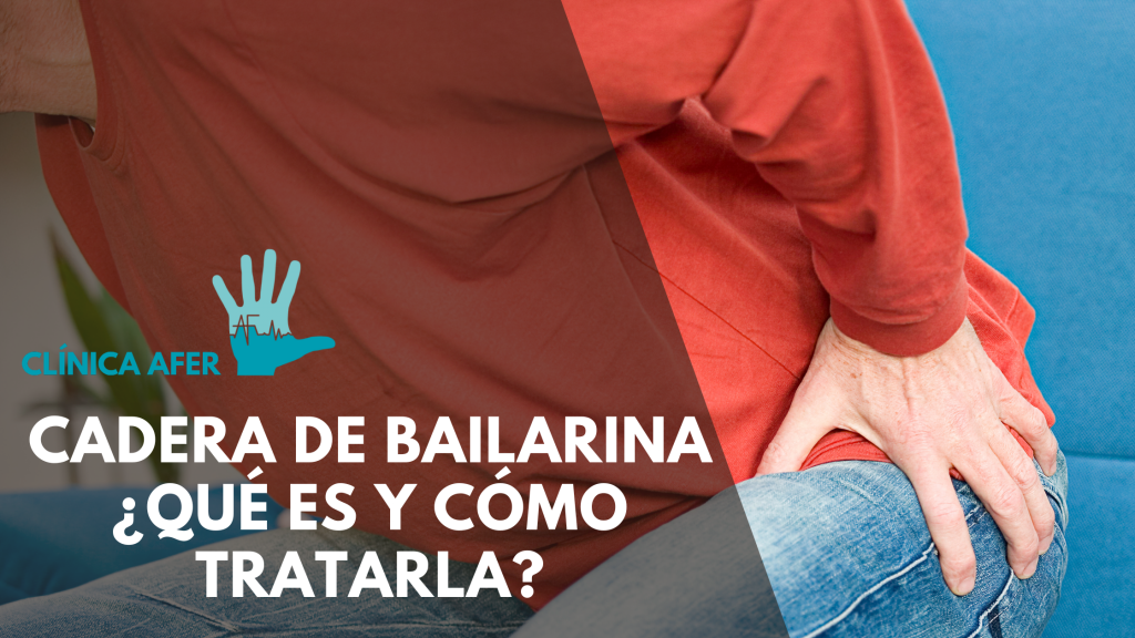 Portada del artículo: ¿Qué es la "Cadera de Bailarina"? Causas, Síntomas y Tratamiento